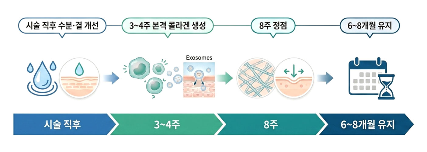 엑소좀 시술 효과 타임라인 (시술 직후 → 8주 정점 → 6~8개월 유지)