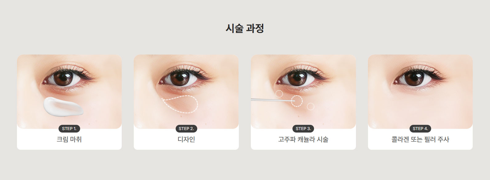 눈비치 케이스별 적합도 - 다크서클 위주, 직장인, 단계적 확인